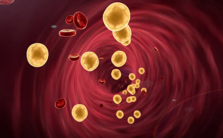How to Recognize the Early Signs of High Cholesterol